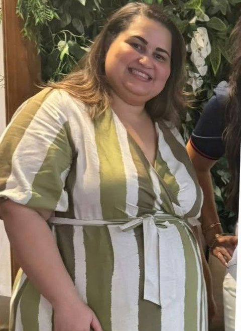 Antes: paciente com lipedema no início do acompanhamento